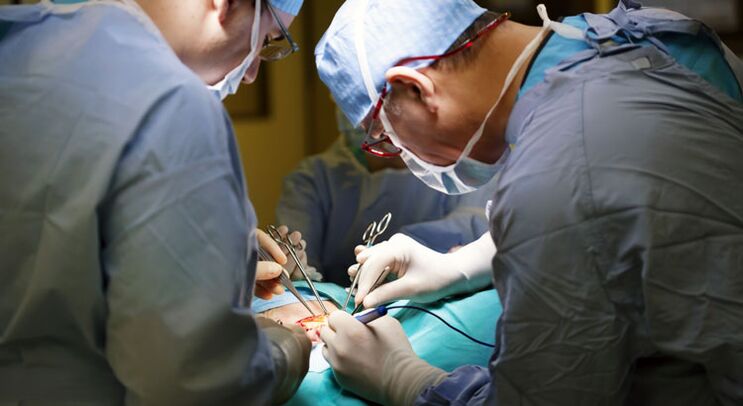 Surgery is performed in advanced stages of chronic prostatitis in men