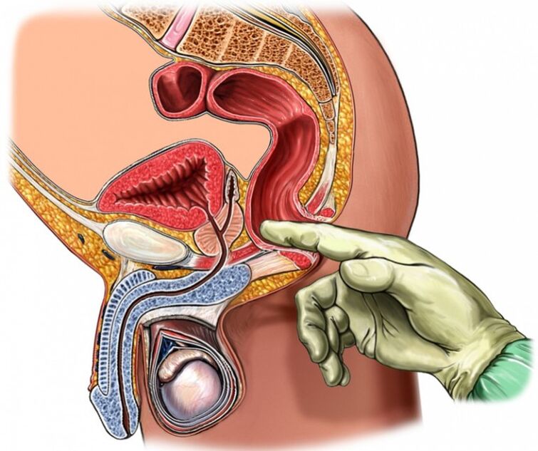 prostate sequence for prostatitis